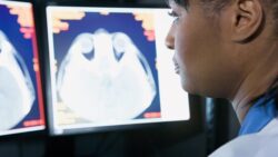 Image: A doctor looks at a brain scan on a monitor. You can see her profile and part of her shoulder; Copyright: envato 