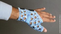Image: A blue 3D printed bandage on a hand; Copyright: Faraz Faruqi and Stefanie Mueller