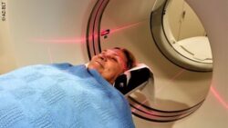 Image: A patient is wheeled into a CT scanner. The patient smiles; Copyright: AZ-BLT 